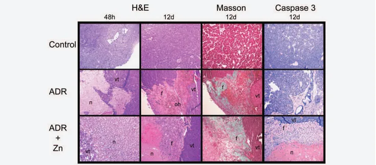Figure 3. Mammary tumors of MMTV- neu mice respond to the combined treatment of adriamycin and zinc