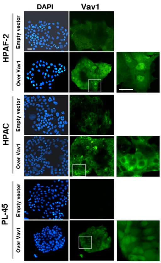 Figure 2. Subcellular localization of Vav1 in PDAC-derived cells. Representative fluorescence  microscopy images of HPAF-2, HPAC, and PL-45 cells, in which cells were transiently transfected  with a construct expressing the full-length human Vav1 (Over Vav