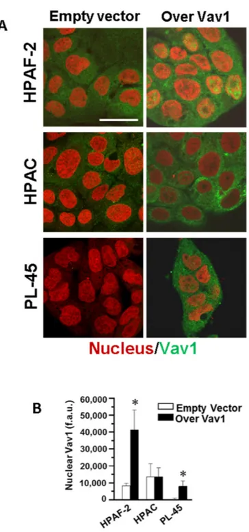 Figure 3. Confocal analysis of nuclear Vav1 in PDAC-derived cell lines. (A) Representative confocal  images of HPAF-2, HPAC, and PL-45 cells transfected with a construct expressing the full-length  human Vav1 (Over Vav1) and stained with the antibody again