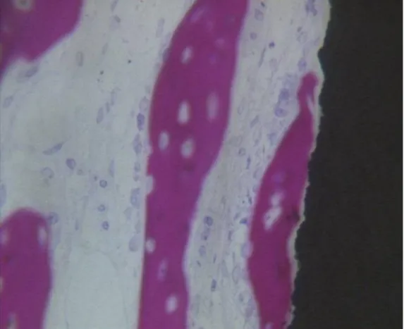 Figure 9. Newly formed bone observed in direct contact to the implant surface. The osteocyte lacunae  were large