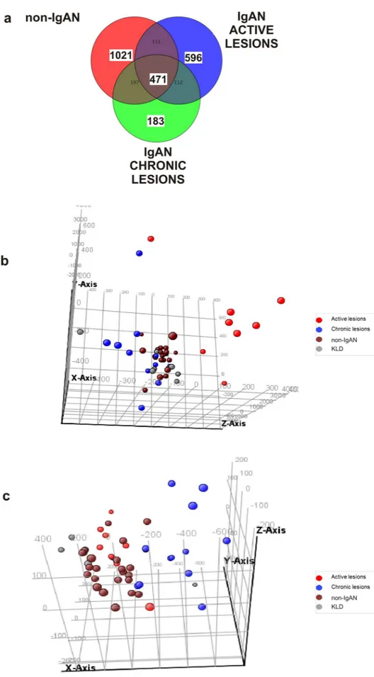 Figure 1.  Specific gene expression signatures in active and chronic renal lesions of IgAN