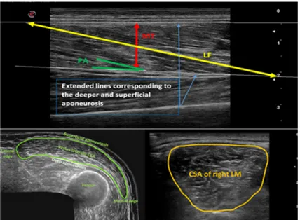 Figure 1. Graphical representation of vastus lateralis and lumbar multifidus ultrasound image 