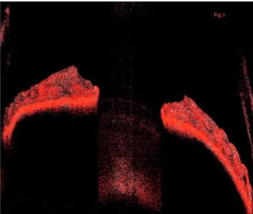 Figure 1. Representation of the B-scan iris image of the OCTA. The segmented boundaries include the  whole iris lumen providing a representative iris vascular network image