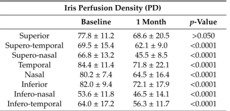 Table 5. AS-OCTA iris parameters compared at baseline and 1 month after SB. Iris Perfusion Density (PD)