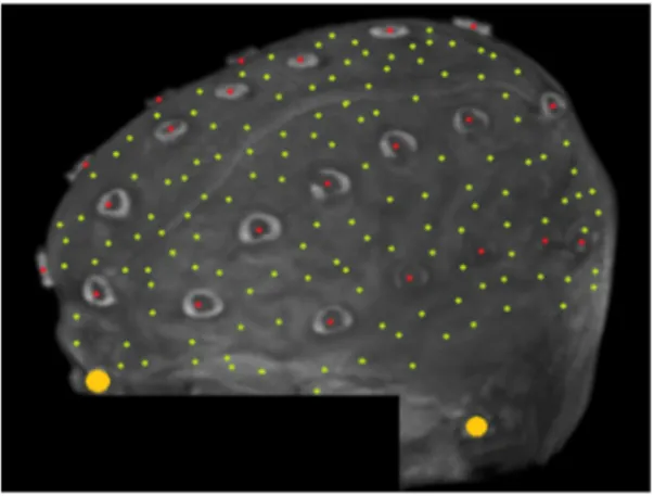 Fig. 1 Locations of the fiducials (large yellow dots), the target loca- loca-tions (red dots), and the additional digitized points (small green dots) from one representative participant, plotted over the corresponding surface-rendered structural magnetic r