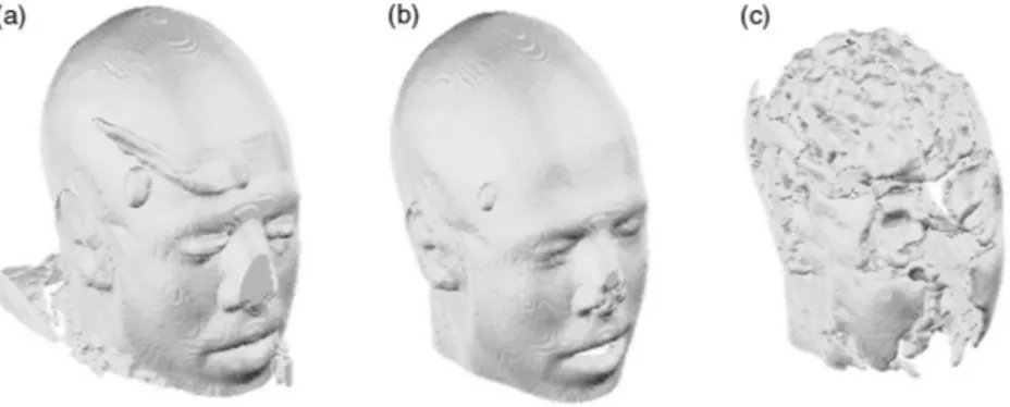 Fig. 2 Extracted scalp surfaces from a structural MRI as a function of different thresholds: (a) low thresh- thresh-old value: 0.01; (b) medium threshthresh-old value: 0.05; (c) high threshthresh-old value: 0.2