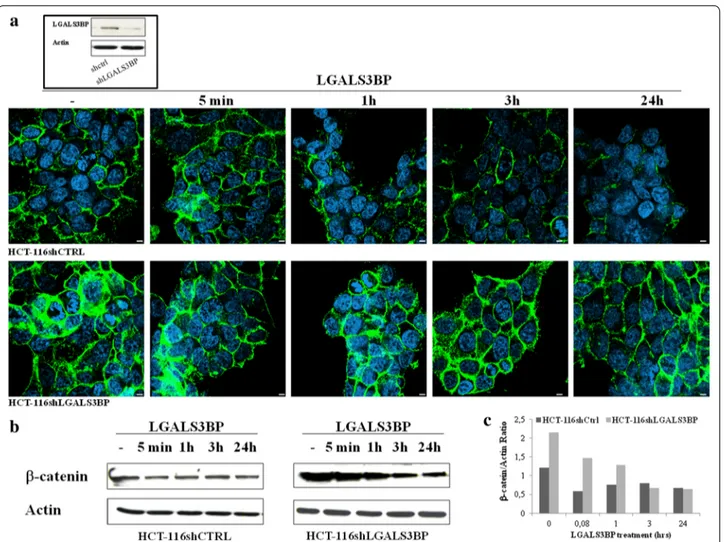Fig. 1  LGALS3BP downregulates β-catenin expression in human colon cancer cells. Expression of β ‐catenin in HCT‐116shCTRL and HCT‐ 116shLGALS3BP HCT‐116 cells after stimulation with LGALS3BP (10 μg/mL) for the indicated times