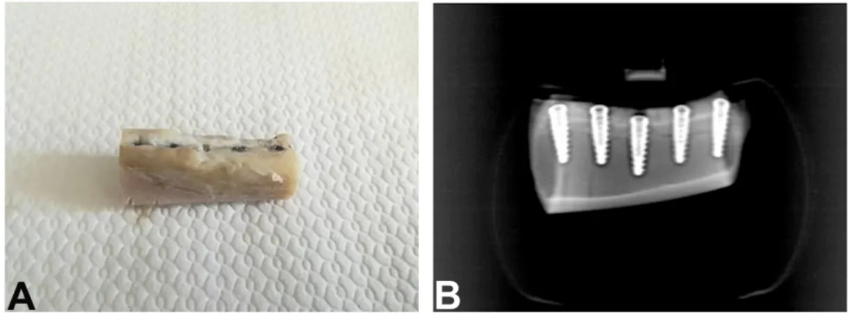 Figure 2. Block section of tibia (A). Rx of the implants inserted in tibia after 1 month of healing (B)