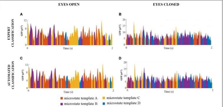 FIGURE 3 | Examples of sequences of global microstate templates for a representative EEG dataset (subject 1 for each condition) denoised after expert and automated classification of the ICs
