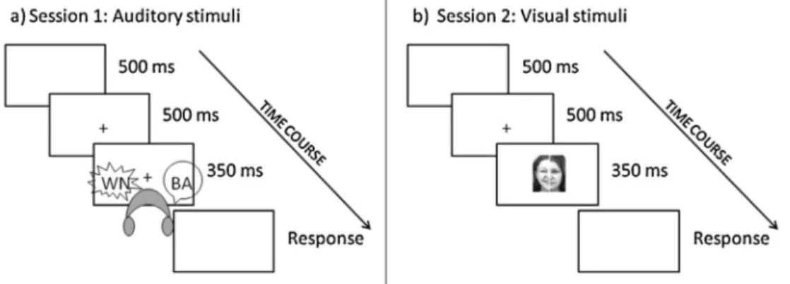 Fig. 3. Schematic representation of a trial in session 1: dichotic stimuli (top panel, on the left); in session 2: chimeric stimuli (top panel, on the right); and in sessions 3 and 4: bimodal presentations, with both dichotic and chimeric stimuli (bottom p