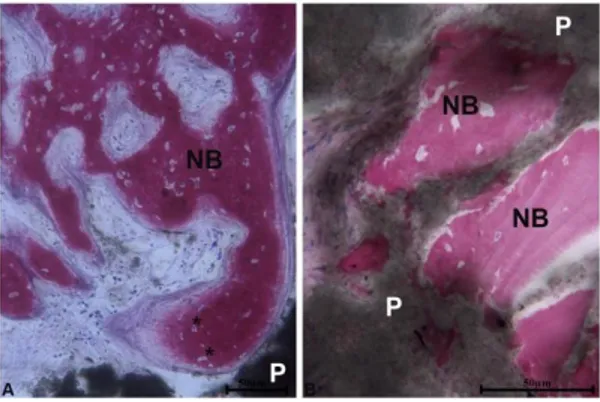 Figure  5.  (a)  Histological  image  showing  newly  formed  bone  (NB),  osteocytes  within  with  large 