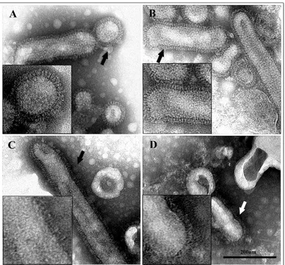 Figure 5. Negative staining of influenza virus particles. At pH 7.4, virions show well-ordered surface 