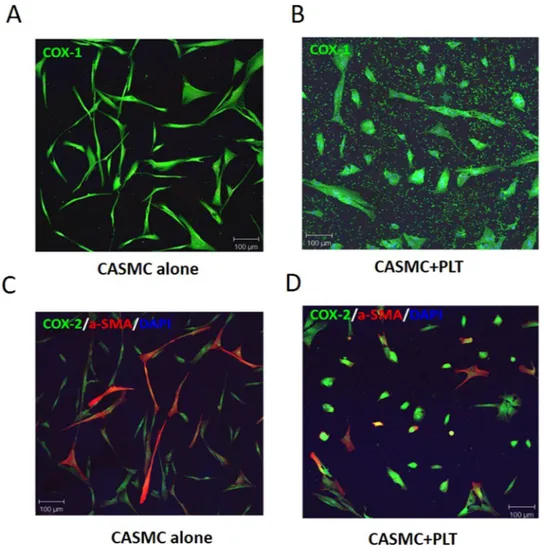 Figure 1.  Effects of platelets on phenotypic modulation of CASMC. Human CASMC (0.8 × 10 5  cells) were 