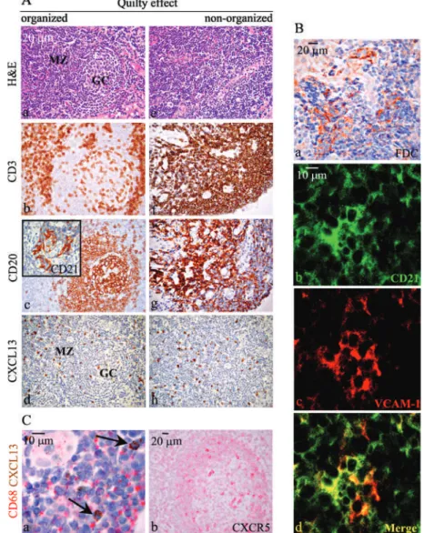 Figure 3: Morphological and immuno- immuno-histochemical features of QE. Panel A.