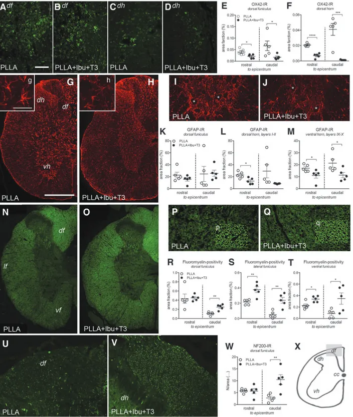 FIG. 5. PLLA-Ibu-T3 scaffolds reduces long-lasting inflammation, scar reaction, and axonal degeneration and increases myelin indices