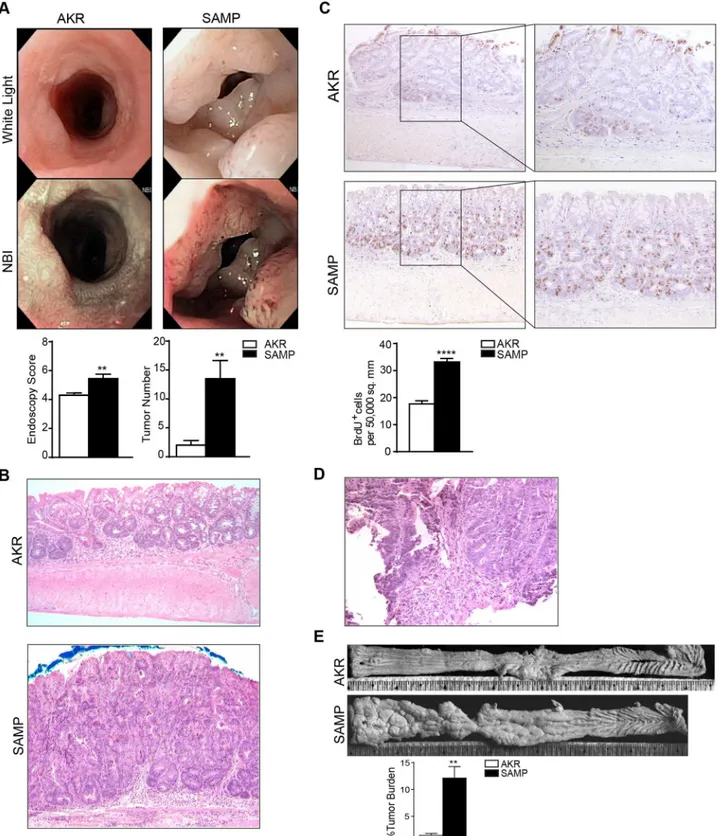 Fig 2. SAMP mice are more susceptible to tumorigenesis after AOM/DSS administration. High resolution endoscopic images of distal