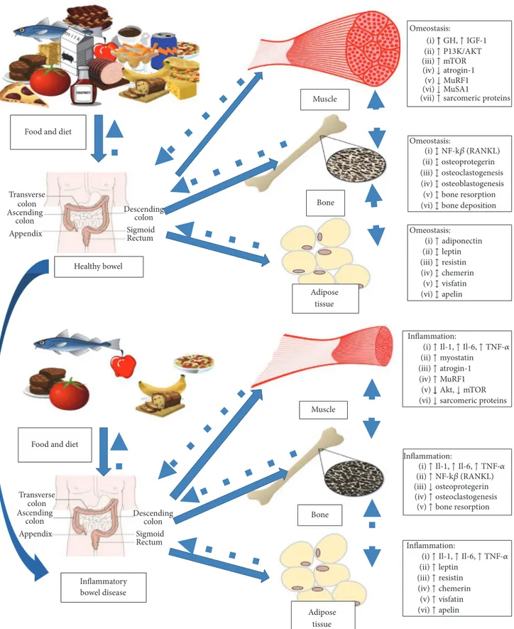 Figure 2: Pathophysiology of malnutrition and sarcopenia in inflammatory bowel disease