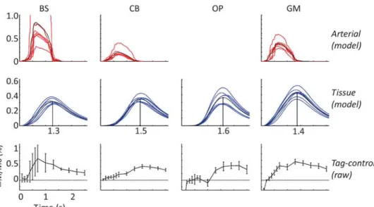 Figure 4. Regional average kinetic curves resulting from the model and raw difference signal for (from left to right) the brainstem (BS), cerebellum (CB), occipital pole (OP), and gray matter (GM) in the feasibility experiment (N ¼ 7)