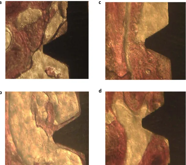 Figure 1. OM analysis of two selected coronal (a,c) and apical (b,d) ROI from two implant specimens at  200x  magnifications.  The  apical  and coronal  side  of  the  implant  specimens  revealed  differences in  their  composition, and the apical side of