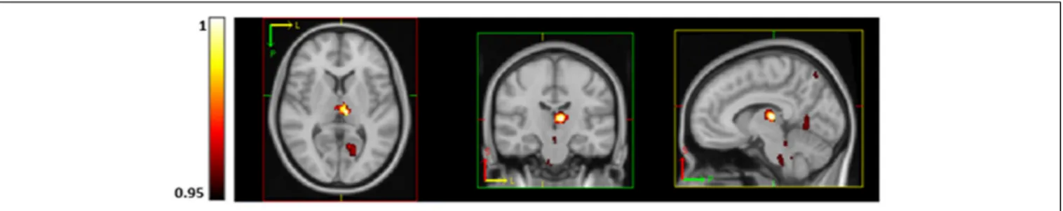 FIGURE 3 | Regions of significantly lower CBF (using TFCE thresholding and FWE corrected) in subjects with higher aerobic fitness at rest in the thalamus, brainstem, precuneus, visual cortex (V1) and lingual gyrus