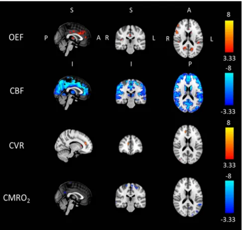 Fig. 6. Results of a group t-test performed between diﬀerences from “pre” to “post” condition in caﬀeine and placebo for the dcFMRI data