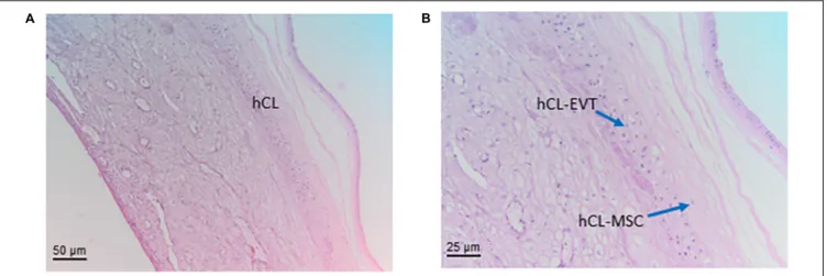 FIGURE 7 | Structure of the chorion laeve. Histological images of human amnio-chorionic membrane (hACM) in correspondence of the chorion laeve (hCL) and the capsular decidua (hCD)