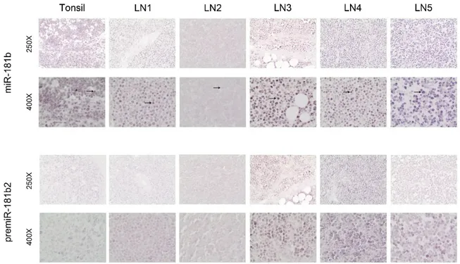 Figure 4. In situ hybridization of miR-181b and the respective pre-miRNA on tissue sections from tonsil of non-cancer 