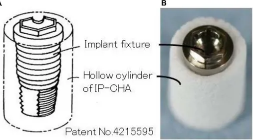 Figure 1. Implant/interconnected porous calcium hydroxyapatite (IP-CHA) Complex. (A) Outline (B) fabricated complex, showing the assembled graft consisting of the IP-CHA and implant fixture.