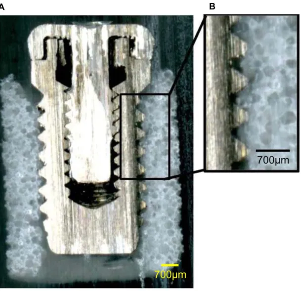 Figure 8. Cross-sectional shape of the Implant/IP-CHA complex. Observation of the cross section of the complex, showing that the implant screw threads and the formed IP-CHA are almost fully3 integrated and there is very little space between the implant thr