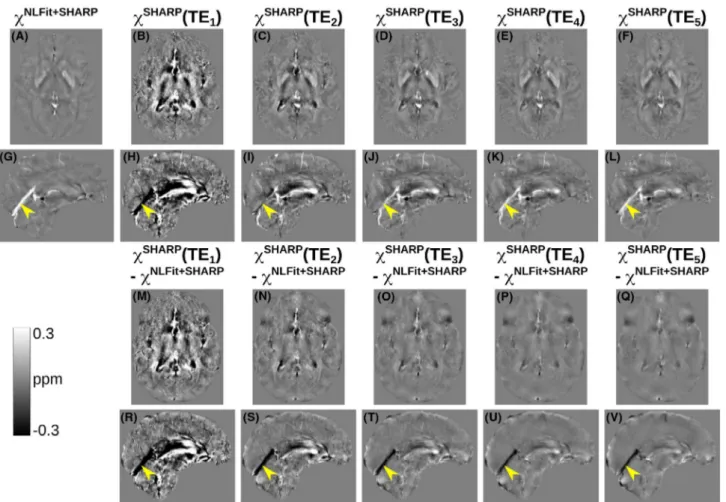 FIGURE 6  Echo time–dependent versus multi-echo χ maps in a representative healthy subject calculated using the SHARP-based processing  pipelines