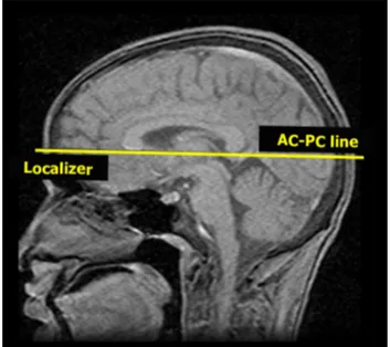 Fig. 3    Head position during MRI acquisition. The anterior commis- commis-sure–posterior commissure (AC–PC) line should be used to align  head position to allow scan comparison, when only 2D acquisitions  are possible
