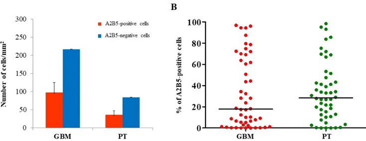 Figure 3. Stereological analysis of BCRP1 expression in both GBM and PT areas. Immunohisto-