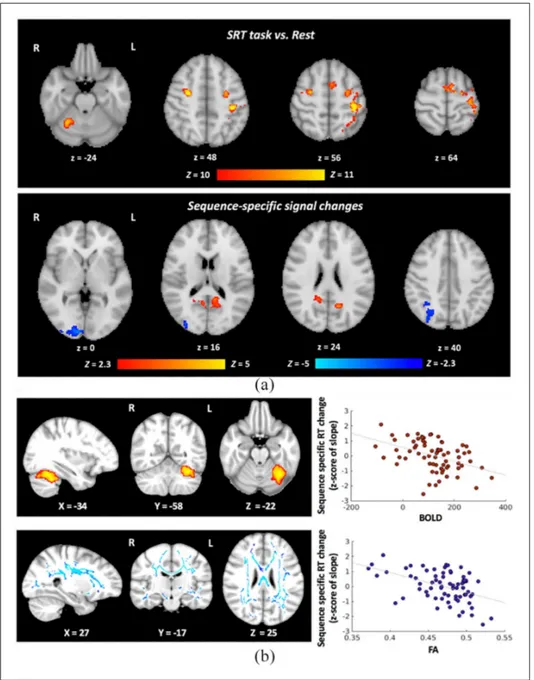 Figure 3.  Group-level results of the SRT task-related functional MRI and functional and structural brain regions  relevant for visuomotor performance improvements with home practice