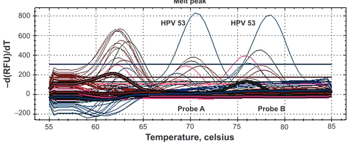 Figure 3 Real-time pCR performed on cervical cancer cells.