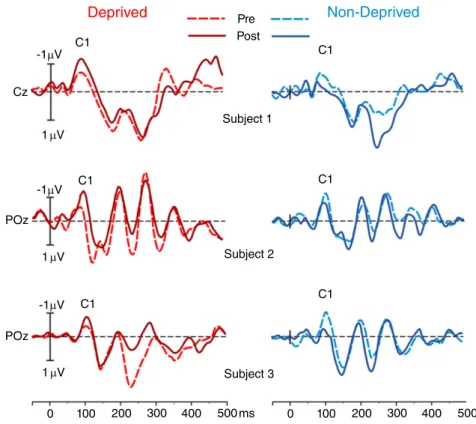 Figure 3A shows the grand-averaged waveforms of the VEP for both the deprived (red lines; upper panel) and the non-deprived (blue lines; lower panel) eye