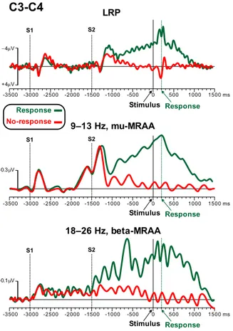 Fig. 4. LRP, mu- and beta-MRAA during the decision and preparation phases for the Response and No-response conditions.