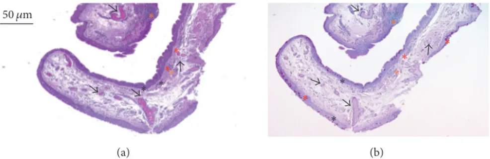 Figure 1: Typical histological features of pterygium. Two serial tissue sections of pterygium were stained (a) with Haematoxylin-Eosin and (b) with periodic acid–Schiff (PAS) staining solutions