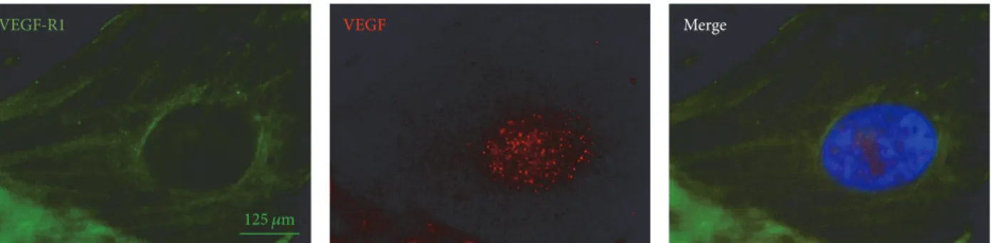 Figure 4: Immunofluorescence analysis of cultured human keratinocytes derived from pterygium explants labelled with anti-VEGF (red