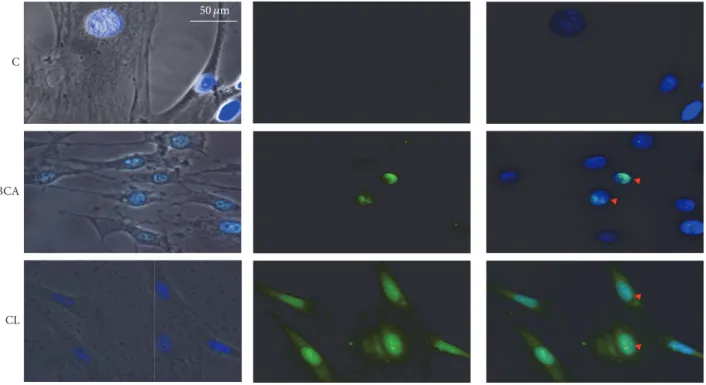 Figure 6: Immune fluorescence labelling of human keratinocytes derived from pterygium explants after treatment with BCA and Curcuma