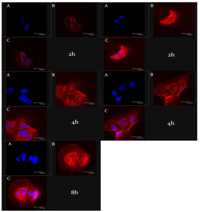 Figure 6. CLSM micrographs of CaCo-2 human colorectal adenocarcinoma cells treated with rho-
