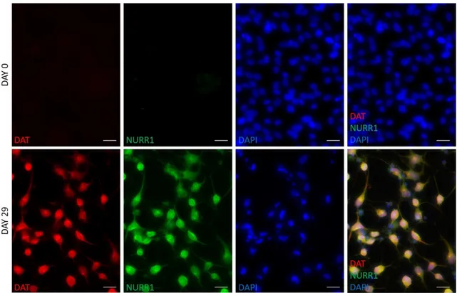 Figure 5. Immunofluorescent analysis of NURR1 and DAT in hFM-MSCs-derived DA neuron-like 