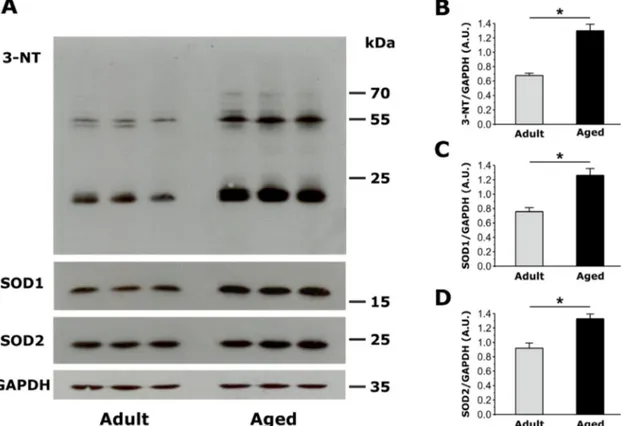 Figure  4:  Assessment  of  oxidative  stress,  measured  as  the  amount  of  total  3-Nitrotyrosine  (3-NT),  copper/zinc  superoxide dismutase (SOD1) and manganese superoxide dismutase (SOD2) expression in EDL muscles from adult  and aged mice