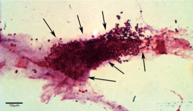 Figure 9. Imaging methods for biofilms – Gram stain. Gram- Gram-stained section of wound tissue debridement samples  col-lected from patients with chronic diabetic foot wounds