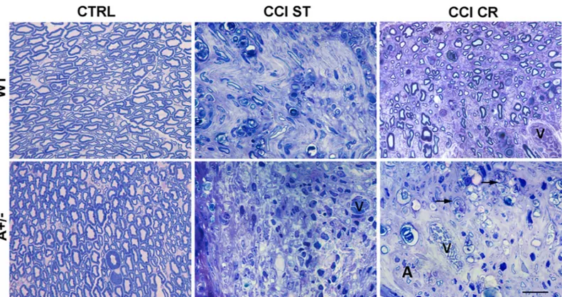 Fig 6. Effects of nerve injury and CR on myelin. Morphological changes in the distal part of sciatic nerves in semithin cross sections from WT and AMBRA1 mice, CTRL or 7 days after CCI