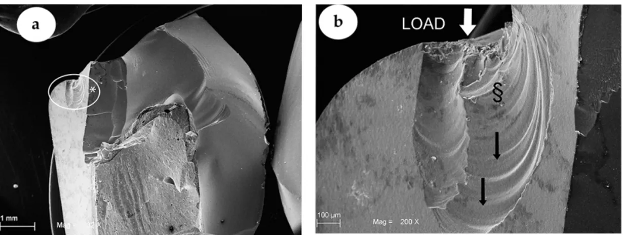 Figure 3. SEM images showing representative ZLS crown of GIC Group. In (a), (32× magnification)  the tracture of a ZLS crown is shown