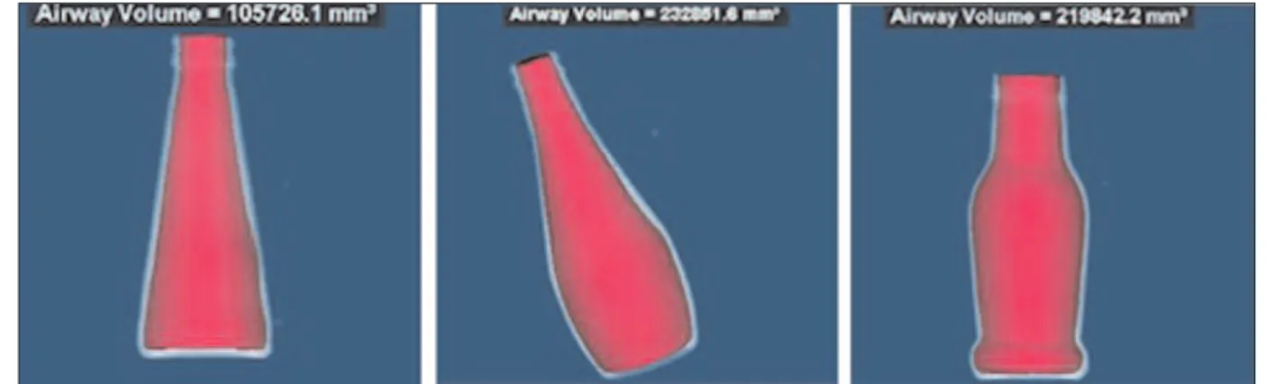 Figure 1. Known-volume phantoms.