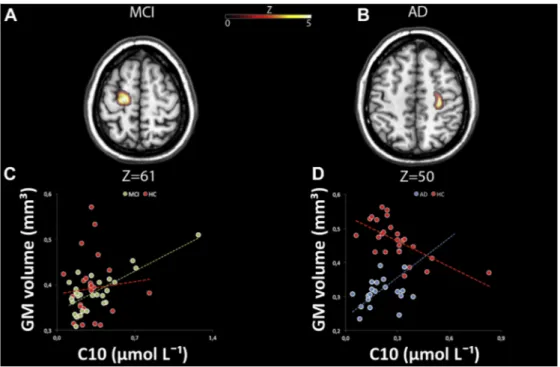 Fig. 4. Relationship between gray matter (GM) volumes and plasma levels of decanoylcarnitine (C10) occurring in MCI and AD patients