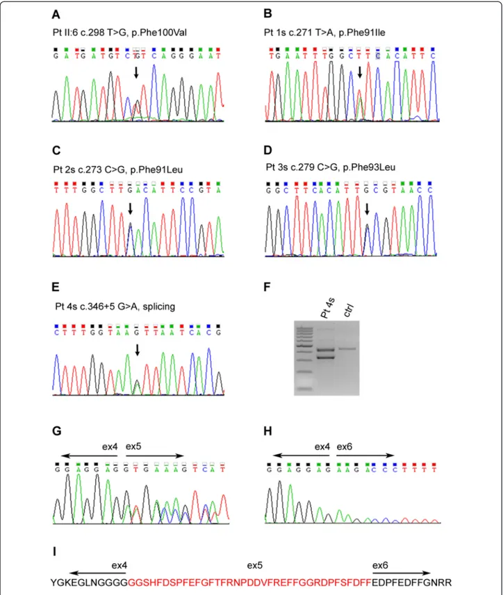 Fig. 5 a –e) Electropherograms showing the mutations in genomic DNA from patients II:6 and patients 1 to 4s