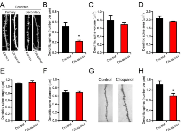 Figure 3.  CQ reduces dendritic spine density in vitro and in ex vivo brain samples. (A) Representative 