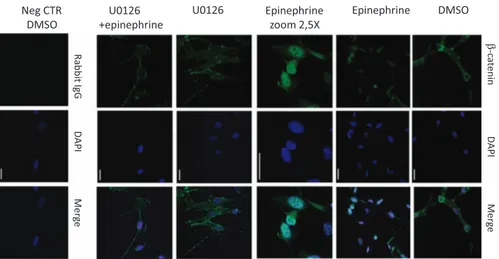 Figure 4 Epi induces β-catenin nuclear translocation. HCMa were pretreated with phospho-ERK inhibitor U0126 (10 μmol/l in dimethyl sulfoxide (DMSO)), or solvent alone, and then stimulated with epi 500 μmol/l for 10 min